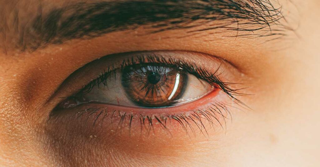 What Are Eye Floaters? Here What To Do If you Start Seeing Them, According to an Eye Doctor - Featured image