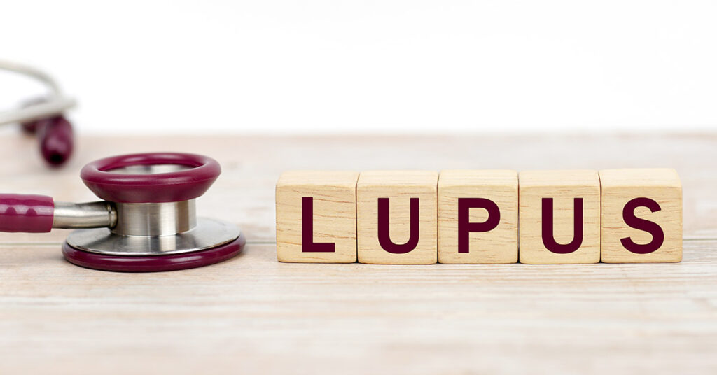 Root Cause of Lupus May Have Finally Been Identified, Scientists Say - Featured image