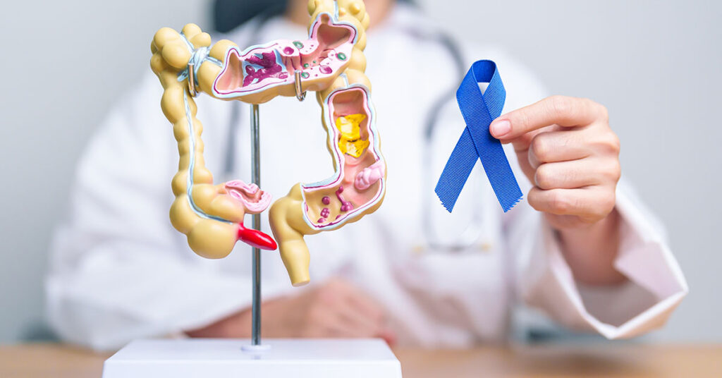 Doctors Reveal Surge Behind ‘Silent Killer’ in Gen Z and Millennials and One Way to Reduce the Risk - Featured image