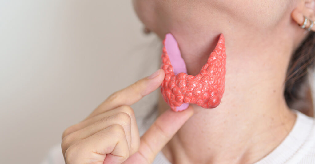9 Foods to Consider Limiting if You Have Hypothyroidism - Featured image