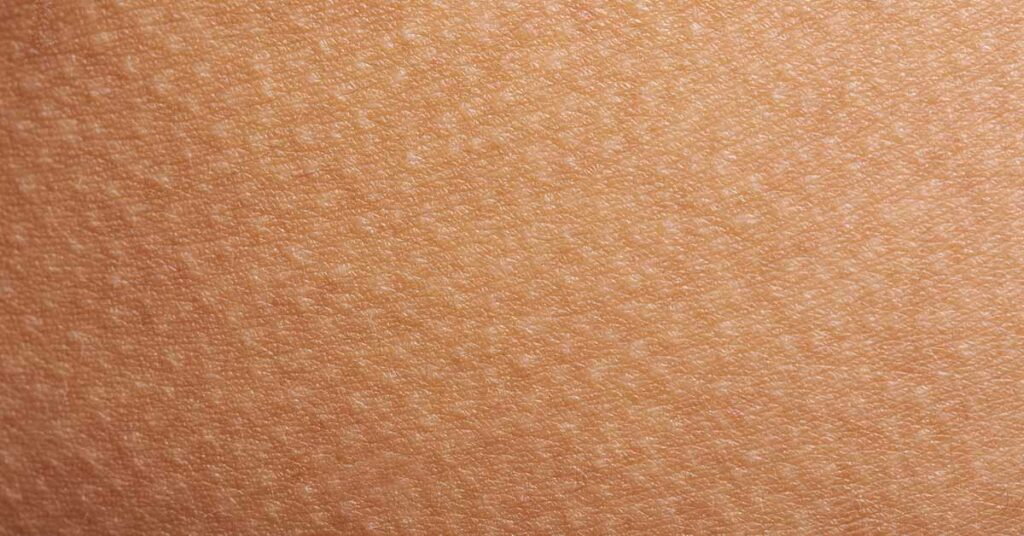 11 Reasons For Raised Bumps On Your Skin - Featured image