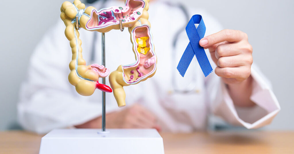 ‘I Thought I was Invincible’ 34-Year-Old Man Diagnosed with Colon Cancer ‘Kicks Himself’ For Ignoring Early Red Flag Symptoms - Featured image