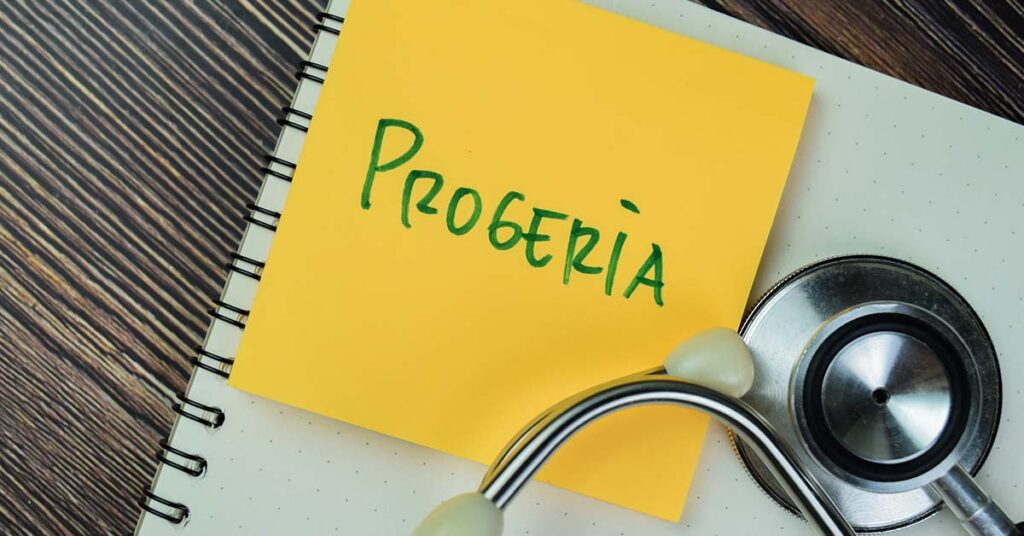 Teen Girl, With The ‘Body of a 152-year-old’, Dies at 19 Due to Rare Condition - Featured image