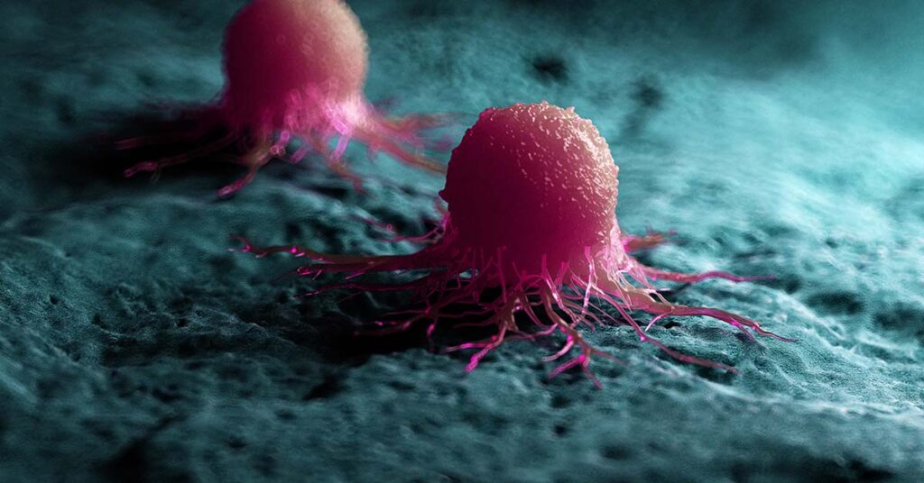 7 Life Hacks Supported By Science To Help Combat Cancer - Featured image