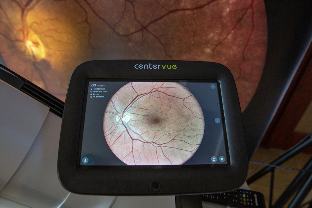 Kyiv, Ukraine - April 18, 2024: CenterVue wide angle retinal camera for ultra high resolution wide field fundus imaging closeup. Is intended for diagnostics of retinal diseases.
