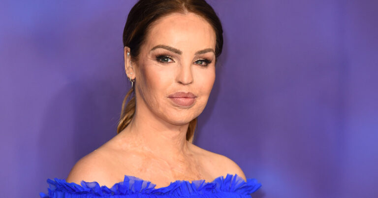 Katie Piper Gives Emotional ‘End of the Road’ Update After Years of Eye Health Battles - Featured image
