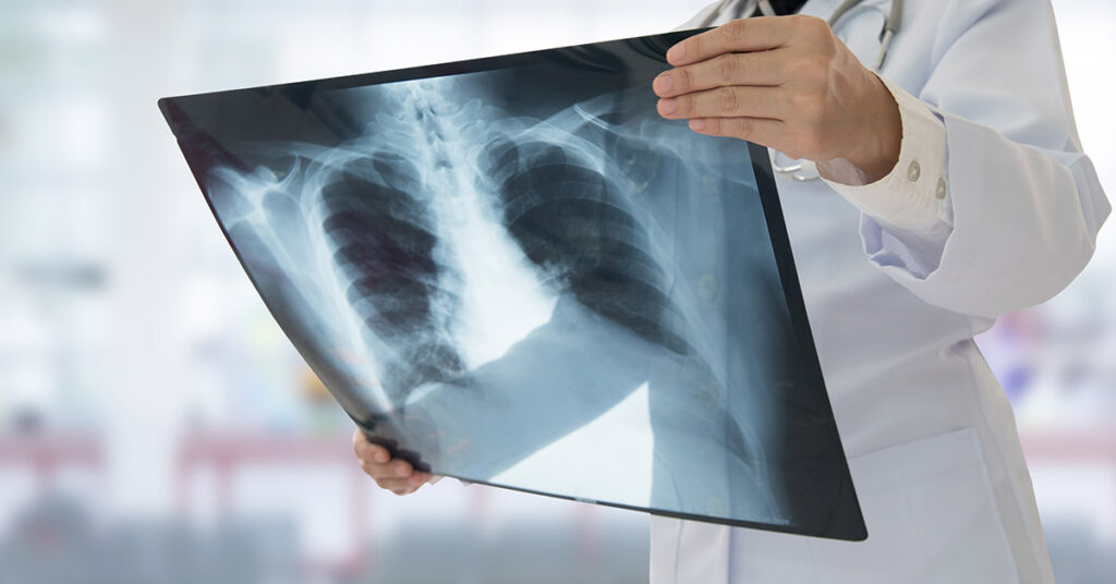 34-Year-Old Woman with Terminal Cancer Reveals 5 Warning Signs She Wishes She Hadn’t Ignored - Featured image