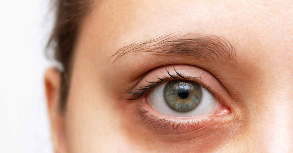 She Thought Her Twitching Eye Was Just Stress—The Shocking Diagnosis Changed Her Life Forever - Featured image