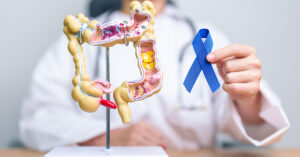 Woman reveals five colon cancer symptoms that should not be ignored Model with cross section of human bowel with person wearing white lab coat holding a blue cancer ribbon