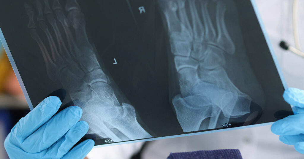 12 Subtle Ways Your Body May Be Warning You About Your Health - Featured image