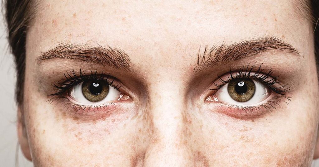 Seven Eye Changes That Should Never Be Overlooked, According to Experts - Featured image