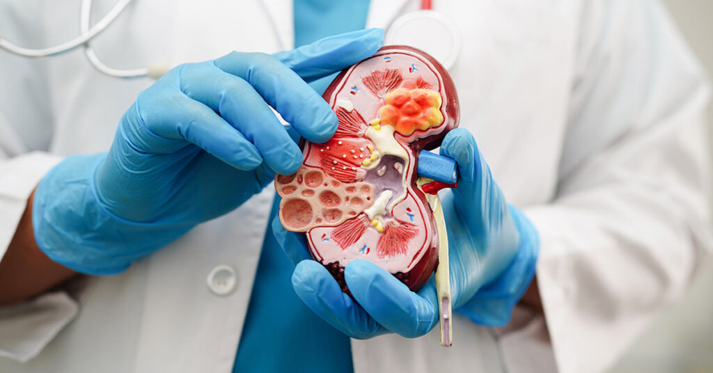 New Study Reveals Concerning Cause Behind Certain Kidney Damage - Featured image