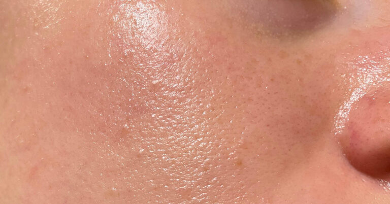 Everyday Things That Are Secretly Ruining Your Skin - Featured image