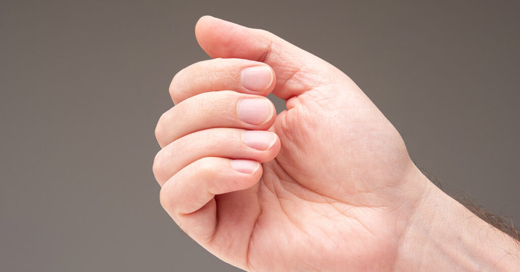Doctor Uncovers A Telltale Sign In Your Fingernails That May Predict Your Life Expectancy - Featured image