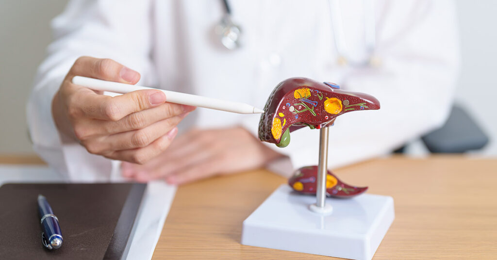 8 Signs of Polycystic Liver Disease - Featured image