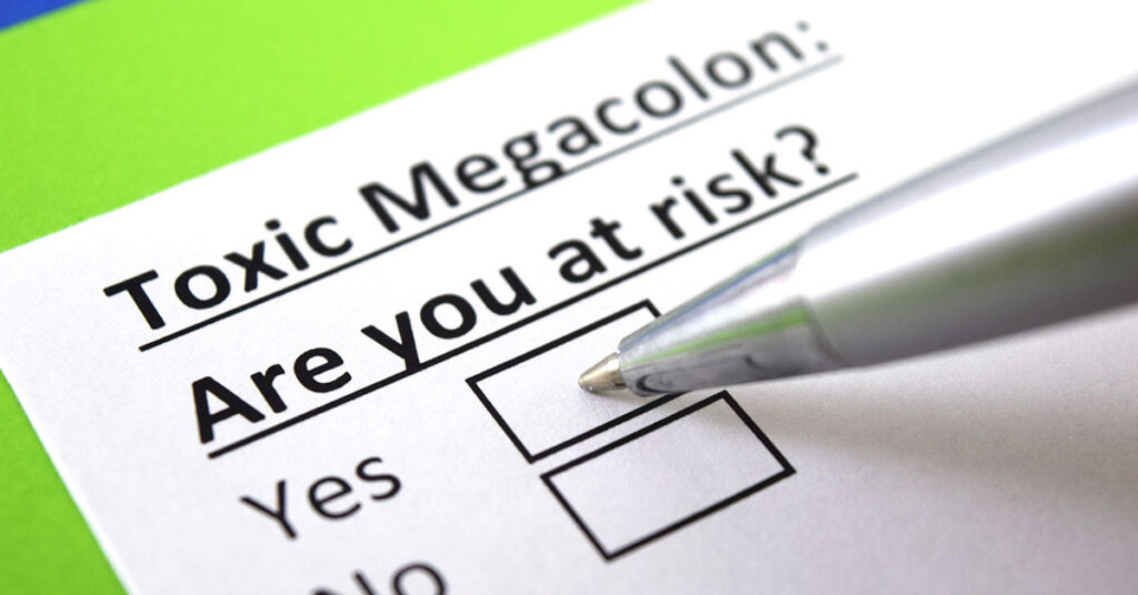 10 Signs of Toxic Megacolon - Featured image