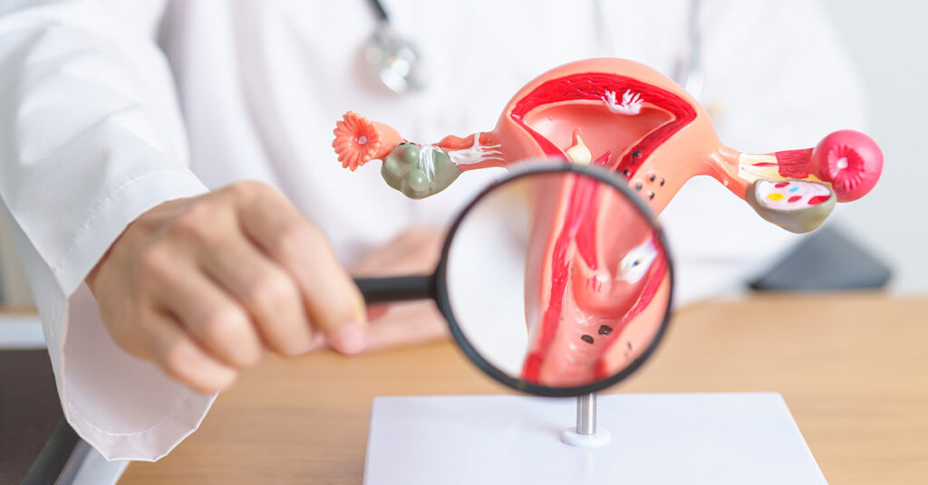 How Much Do You Know About Cervical Cancer? - Featured image