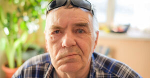 Bell’s Palsy: What Causes It, and Symptoms to Look Out For man displaying symptoms of Bell's Palsy