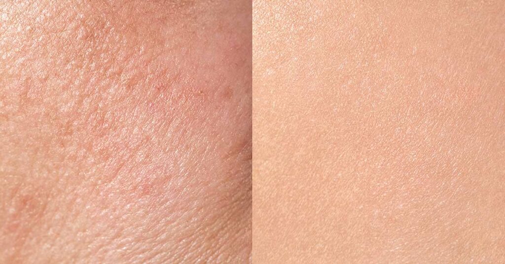 Scientists ‘Reverse Aging’ in 53-Year-Old Woman’s Skin Cells by 30 Years - Featured image