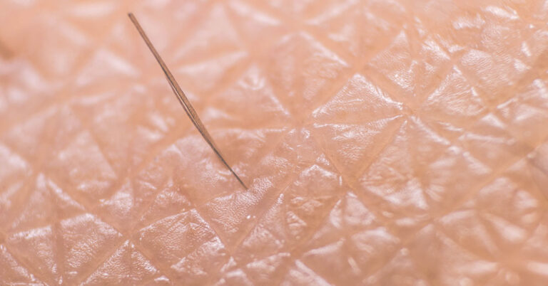 Startling Simulation Reveals What Happens When You Pluck a Hair from Your Skin - Featured image