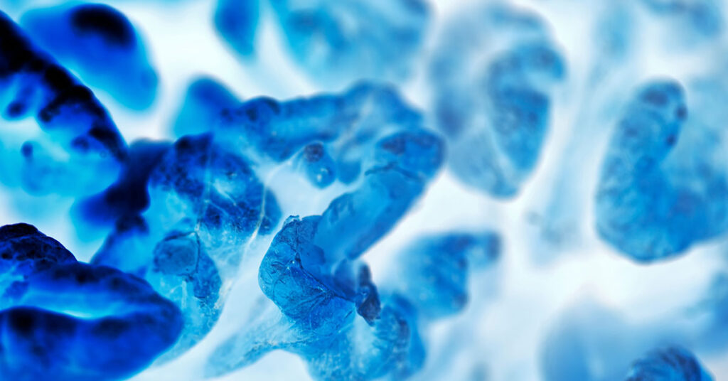 New Study Identifies Protein That Keeps Cancer Cells in Dormant State - Featured image