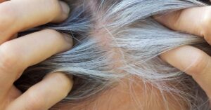 graying hair