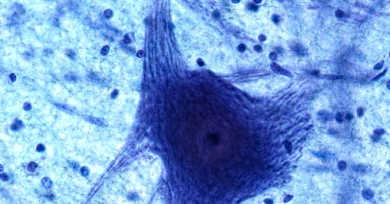 In A World First, Scientists Create Computer That Runs On Living Human Brain Cells - Featured image