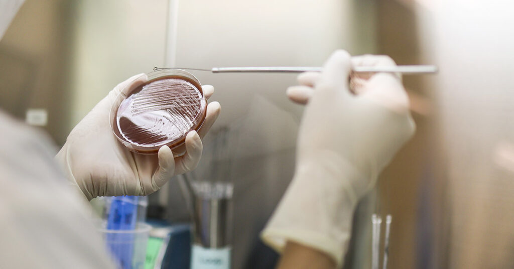 New Sexually Transmitted Infection: Doctors Warn It May Already Affect Millions - Featured image