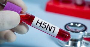 blood vile labelled H5N1. Bird flu concept