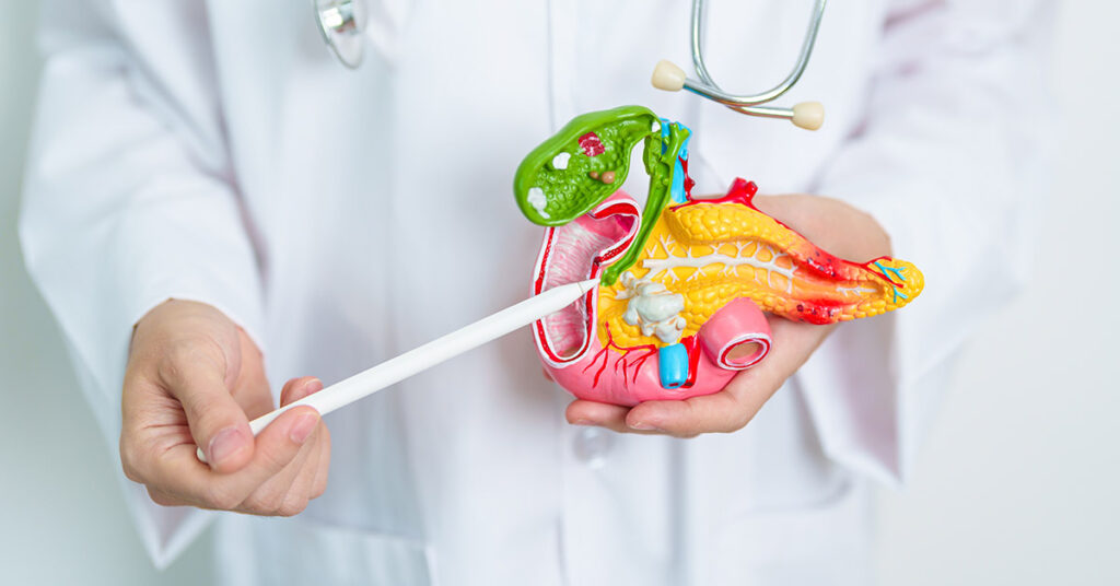 Breakthrough Discovery Paves the Way for Treating One of the World’s Most Lethal Cancers - Featured image