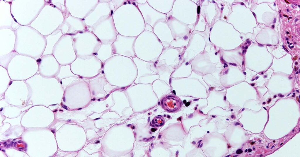 Fat Cells ‘Remember’ Obesity, Offering Clues to Why Weight Loss is So Challenging - Featured image