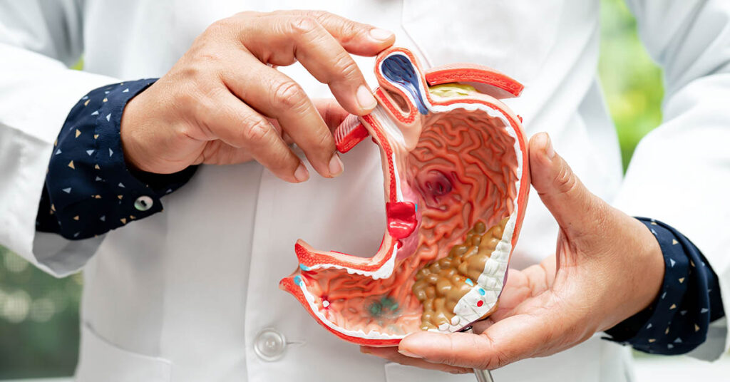 9 Crucial Signs of Stomach Cancer to Watch for and Treat Early - Featured image