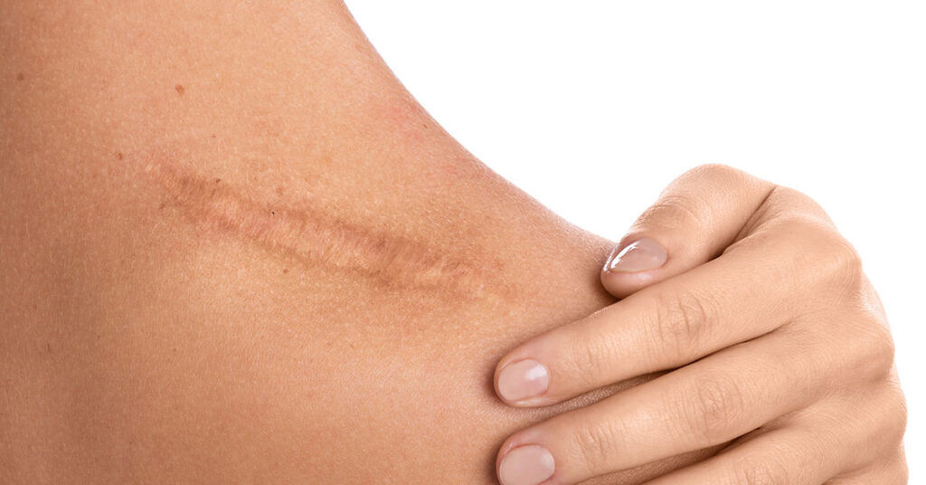 Scientists Develop Gel That Self-Heals Similar to Human Skin - Featured image