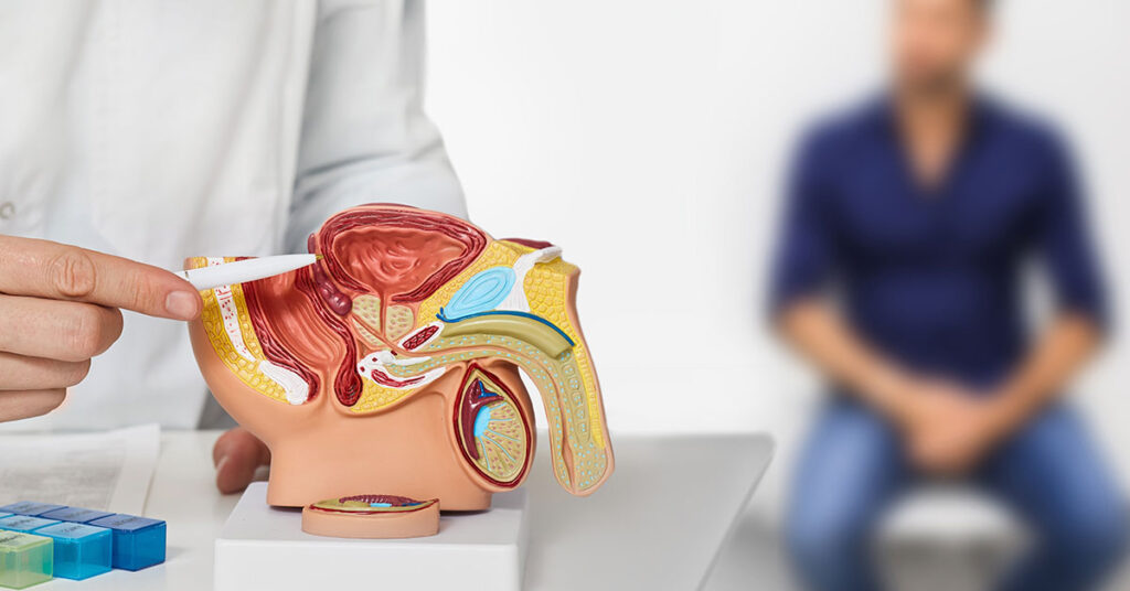 Men Who Neglect This Crucial Practice Face 45% Higher Risk of Prostate Cancer - Featured image