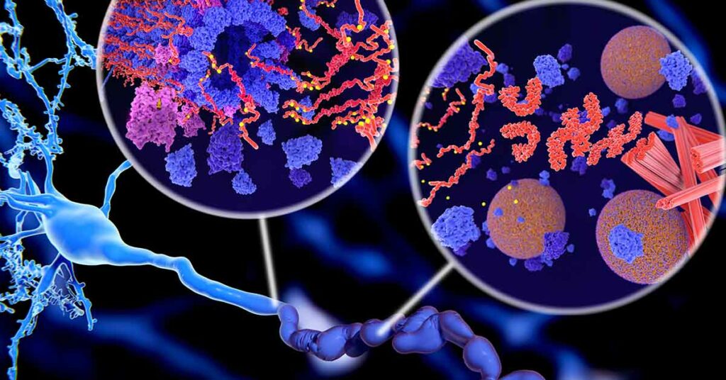 How to Reduce Toxic Tau Protein and Lower Alzheimer’s Risk - Featured image