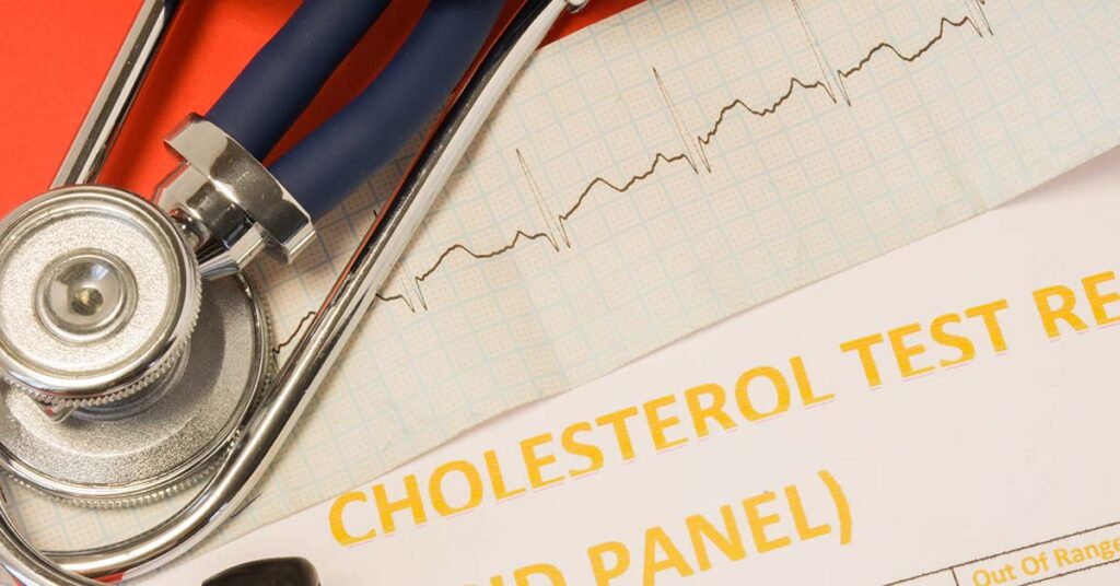 4 Simple Lifestyle Changes  More Effective Than Statins for Cholesterol, Doctor Claims - Featured image
