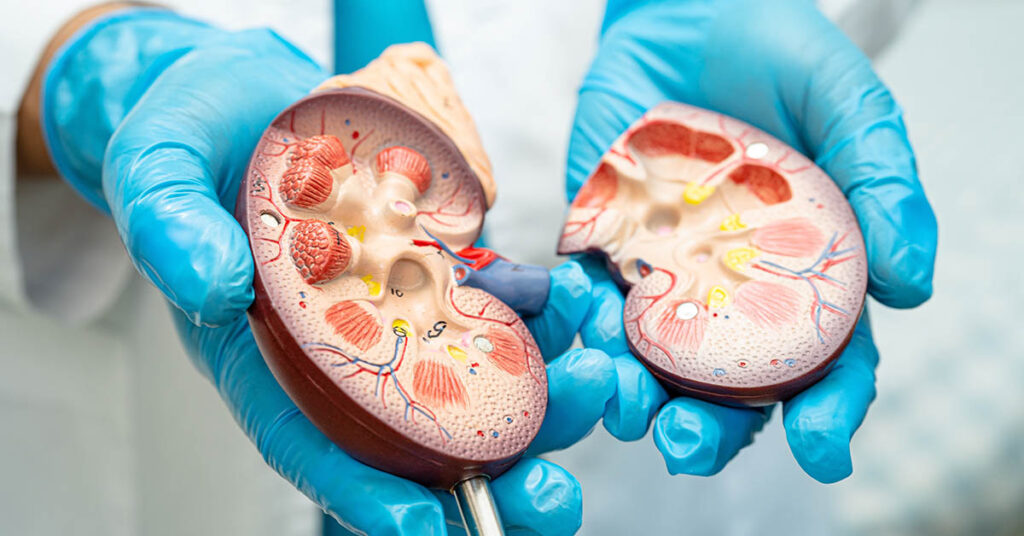 6 Key Factors That Can Influence the Progression of Kidney Disease - Featured image