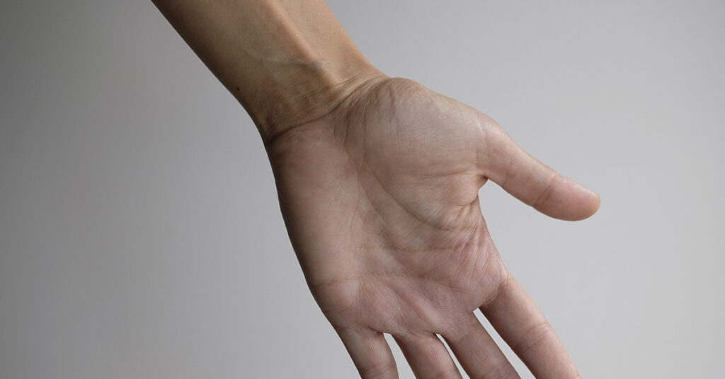 If a Tendon Raises Up When You Touch Your Pinky to Your Thumb, Here’s What It Could Mean - Featured image