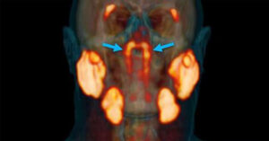 Scientists May Have Accidentally Discovered New Organ Inside The Human Head oct19_part02_28