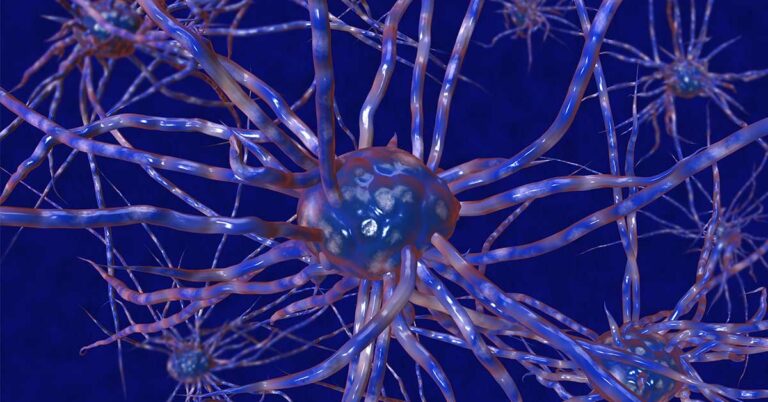 Brain Iron Levels Could Shed Light on the Connection Between ADHD and Dementia - Featured image