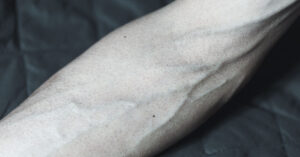 Lifelike Humanoid Robot with Muscles and Bones Awakens for the First Time close up of forearm of man