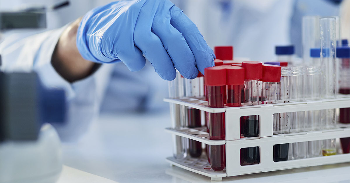 Science, blood test and hands of person with sample for biotech engineering, pathology and hematology research. Laboratory, exam and scientist with glucose analysis, development or medical study