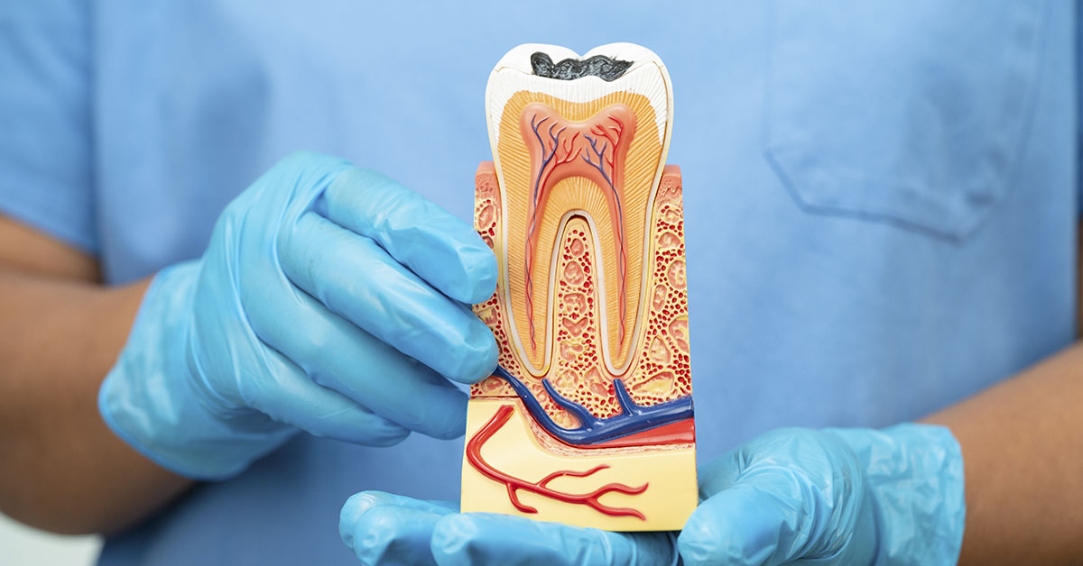 dentist holding a model of tooth and underlying gum anatomy
