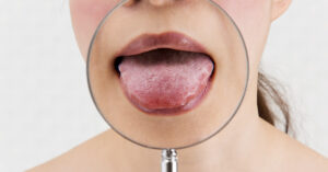 11 Things Your Tongue is Telling You About Your Health magnifying glass placed over woman's mouth with her tongue sticking out. Investigating Tongue health