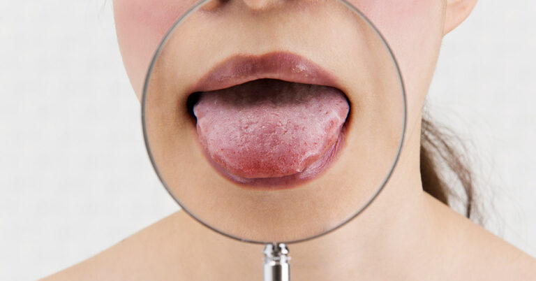 11 Things Your Tongue is Telling You About Your Health - Featured image