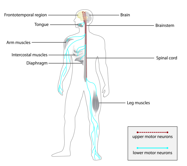 A anatomical diagram of the human body highlighting the motor neuron pathways affected by ALS (Amyotrophic Lateral Sclerosis). It illustrates both upper motor neurons (shown as red dotted lines) and lower motor neurons (shown as blue/teal lines) connecting the brain, brainstem, and spinal cord to various muscle groups. The diagram labels key affected areas including the frontotemporal region of the brain, tongue, arm muscles, intercostal muscles, diaphragm, and leg muscles. Demonstrating how ALS might impact Eric Dane nervous system's control of voluntary movement throughout the body.