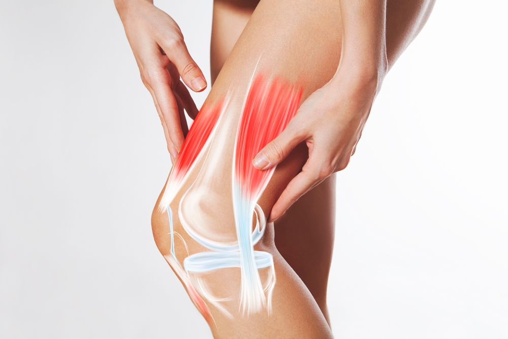 Knee pain, meniscus inflamed, human leg medically accurate representation of an arthritic knee joint. Persistent, sharp discomfort in the knee joint, accompanied by swelling and stiffness