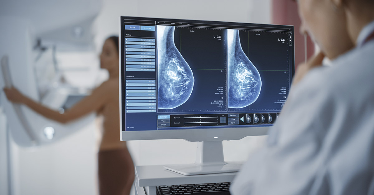 Doctor examining mammogram results on a monitor