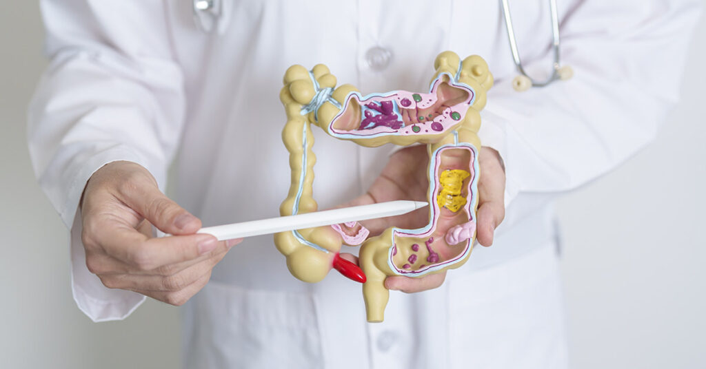 Against the Odds: Terminal Colon Cancer Patient Recovers After Experimental Therapy - Featured image