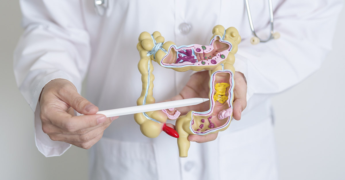 Doctor pointing to 3d model of colon. Colon health and colon cancer concept